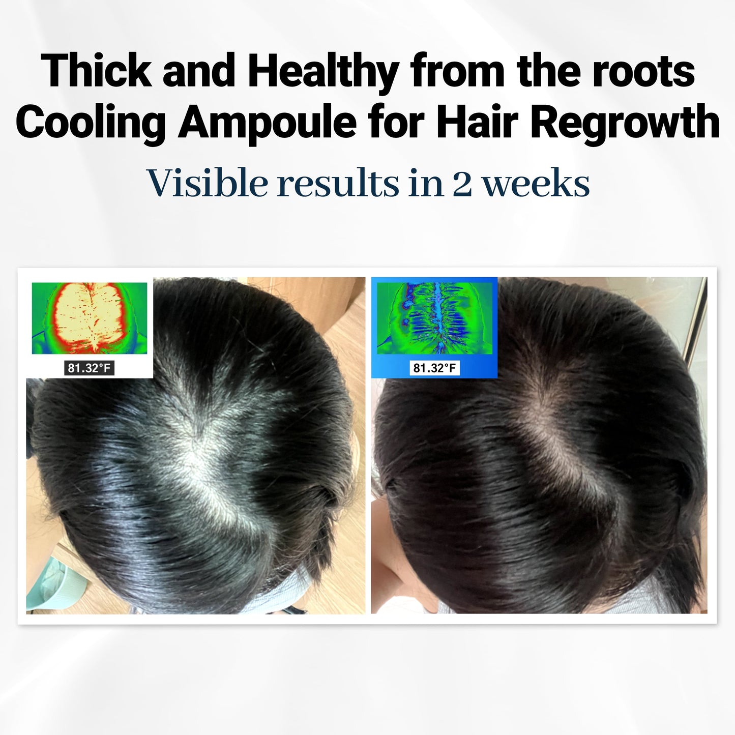 Scalpy™ Cooling Hair Ampoule | Scalp Health & Regrowth