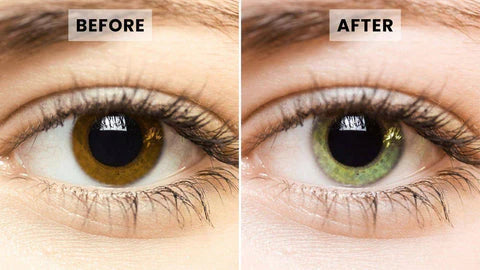 AQA™ SpectraEye – Eye Drops to Change Eye Colour
