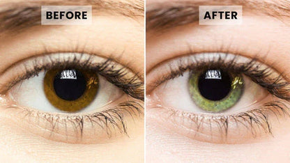 AQA™ SpectraEye – Eye Drops to Change Eye Colour
