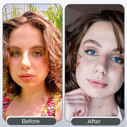 AQA™ SpectraEye – Eye Drops to Change Eye Colour