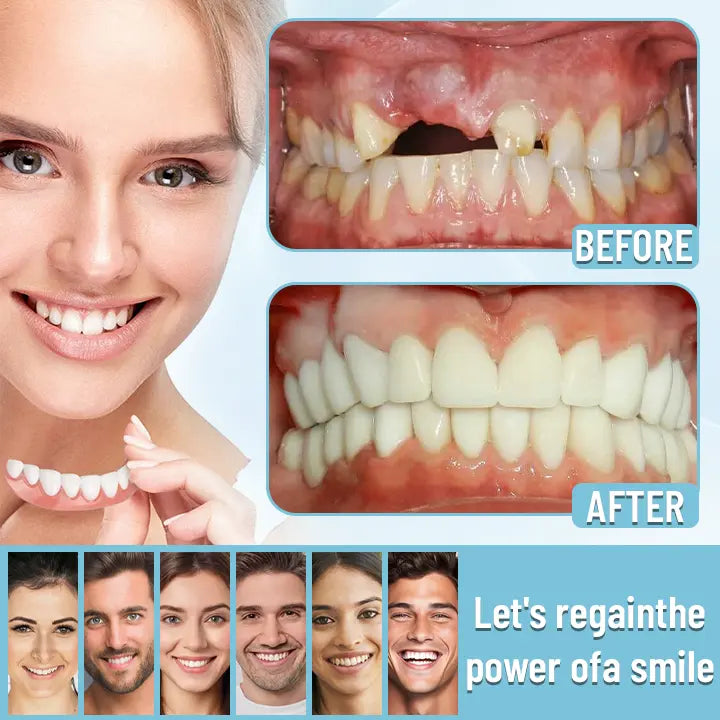 DentureSet Pro | Complete Denture Set