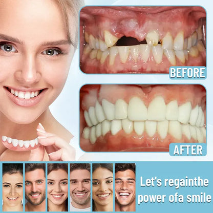 DentureSet Pro | Complete Denture Set