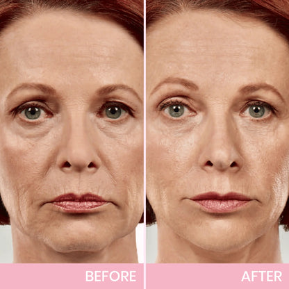 InvisiLift™ | Invisible Adhesive Tape for Facial Lifting